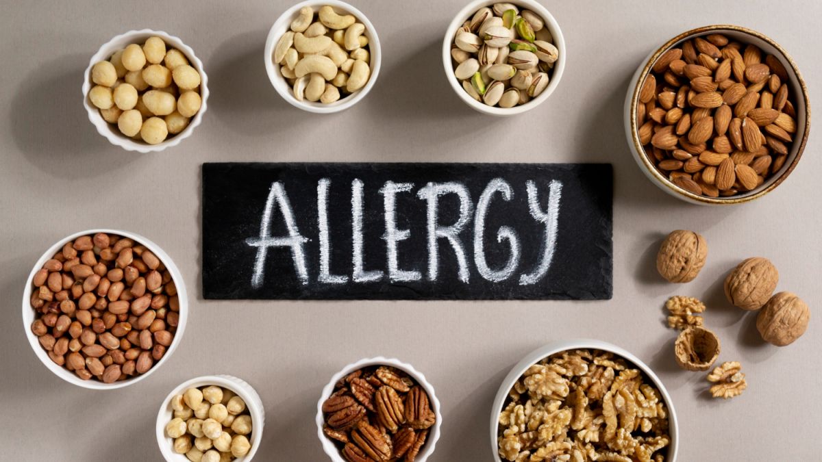 La vida cotidiana con alergias: los alérgicos deben prestar atención a estos puntos cuando se trata de alimentos